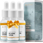 Abera Melasma Serum, Melasma Treatment for Face, Dark Spot Corrector Serum, Melasma Dark Spot Remover, Sun Spot, Age Spot, Brown Spot Remover for Men, Women (0.68 Fl. Oz)