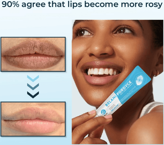 Belani Fordyce Spots Lip Cream, Traitement hydratant pour lèvres foncées, Graines de Fordyce 0,7 fl oz