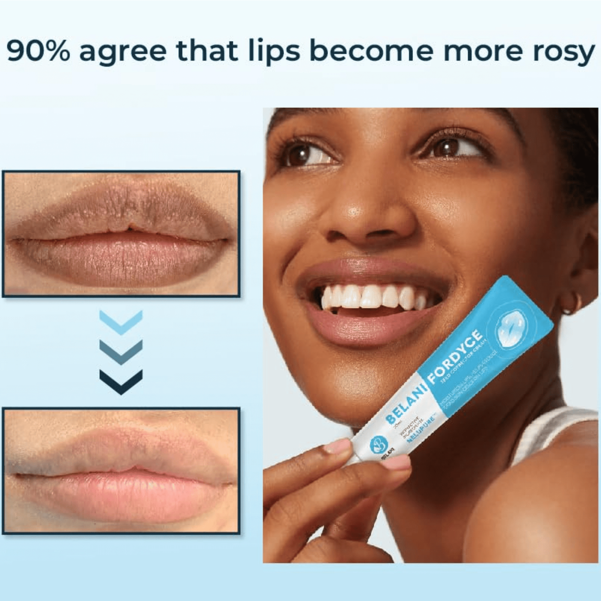 Belani Fordyce Spots Lip Cream, Traitement hydratant pour lèvres foncées, Graines de Fordyce 0,7 fl oz