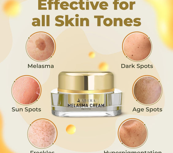Crème anti-mélasma ABERA