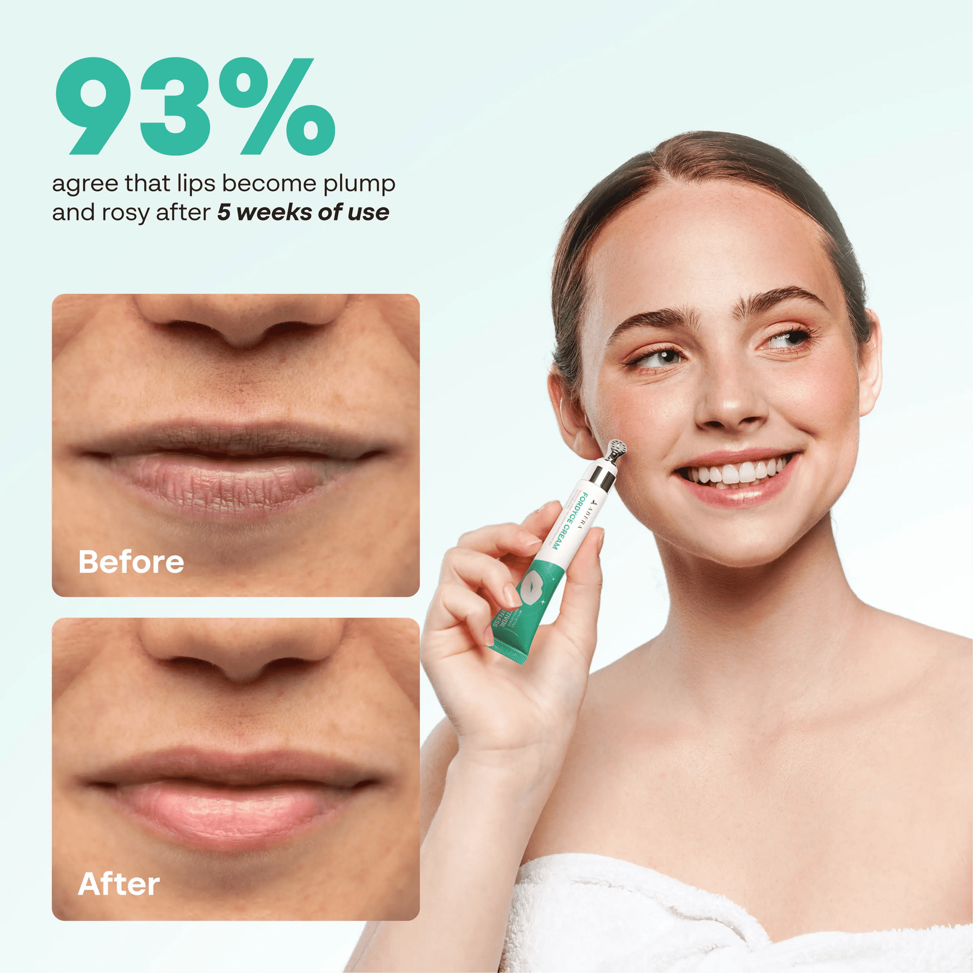 Abera Fordyce Cream – Advanced Formula with HPR (Next-Gen Retinoids), For Lip Acne, Dry, Chapped Lips (0.7 Oz)